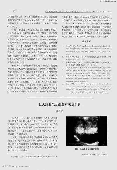 期刊巨大腮腺混合瘤超声表现1例被引量:1   患者男,45岁.