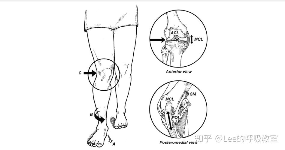 『经验杂谈』关于课间操引起的足底筋膜炎,足跟痛,扁平足的思考!(—)
