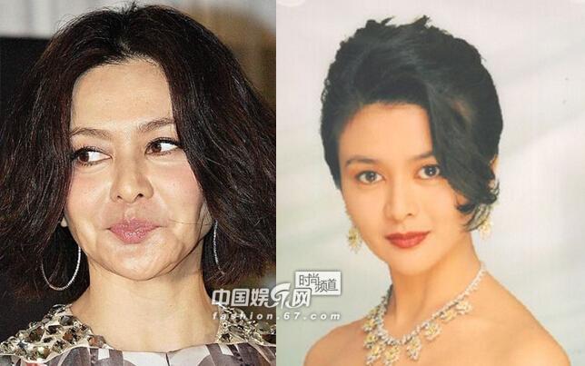 图揭女明星皮肤松弛毁所有 高圆圆双颊下垂似衰老十岁
