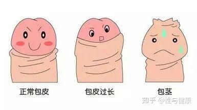 别不信, 3岁后仍然缓解不了的男宝还真不少,有的是一直包茎,有的是