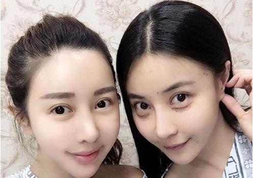 四大名助整容女于冰微博遭人肉 于冰整容前后对比照惊人
