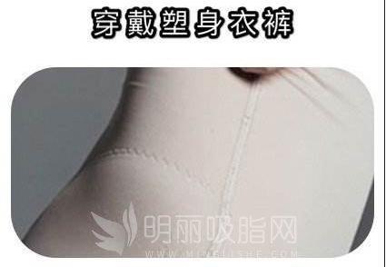 腹部吸脂手术的副作用,并发症及反弹