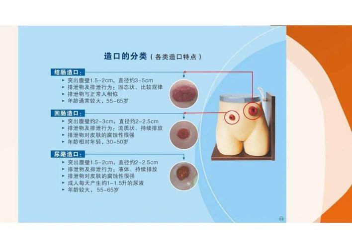 【ppt】肠造口术后的护理