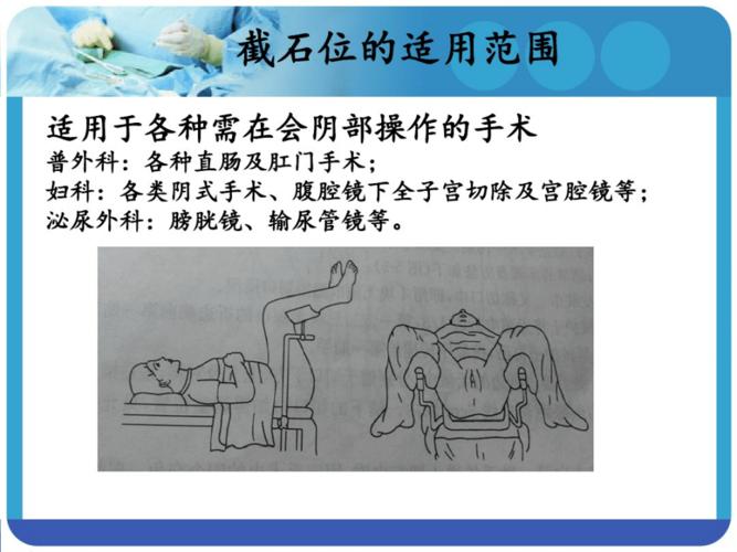 手术室截石位体位摆放.pdf 19页