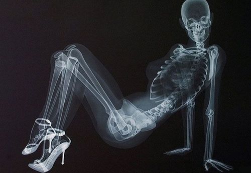 日本一扫描仪用女模特x光透视骷髅做广告(组图)可以不净观_善知所趣吧