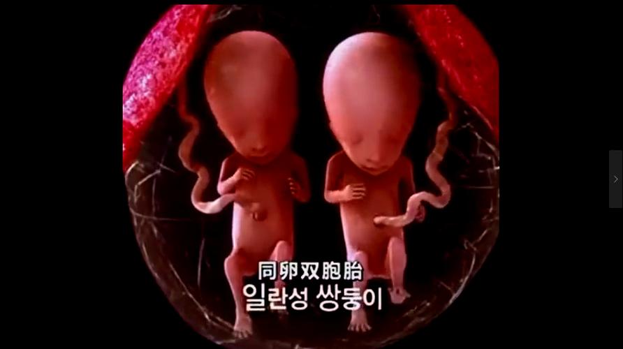 双胞胎是在妈妈的肚子是如何生长的,真神奇!