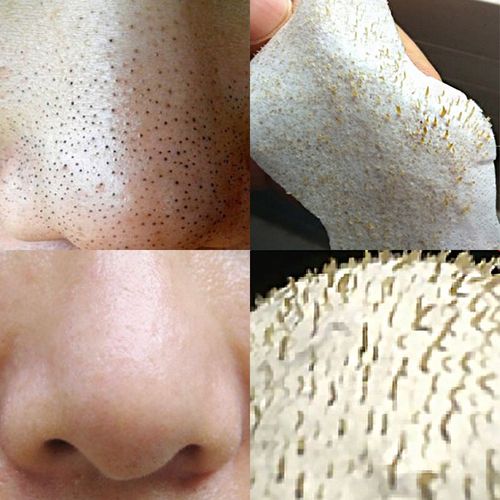 泰国去黑头鼻贴 white芦荟胶撕拉式祛粉刺吸黑头神器绿瓶买一送一