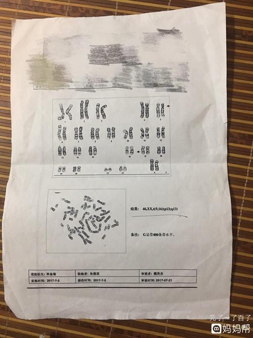 染色体异常 自怀要不要羊水穿刺