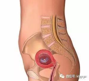 胎儿每个月在妈妈肚子里的胎位和姿势