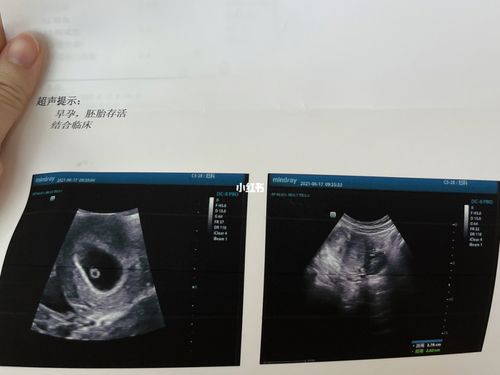 新鲜的胎心胎芽来啦!