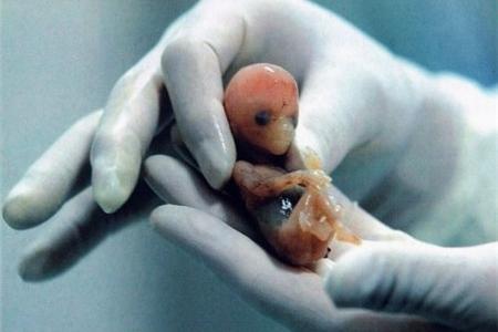 怀孕7周妊娠囊有多大