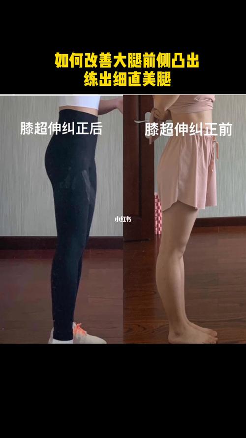 大腿前侧凸出解决方案_骨盆_跑步_腿型矫正_运动健身