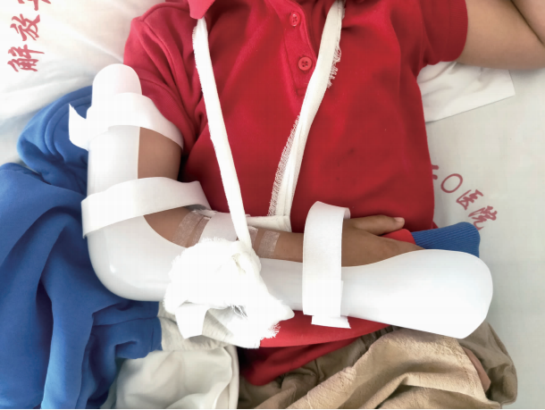 监控曝光昆明5岁男童被人推下滑梯致手臂骨折家长急寻肇事者