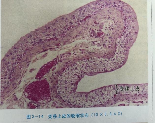 变移上皮收缩状态transitional epithelium contracted state.