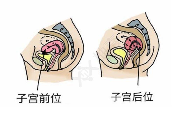 子宫前位受孕并不难,教你2招轻松有好孕