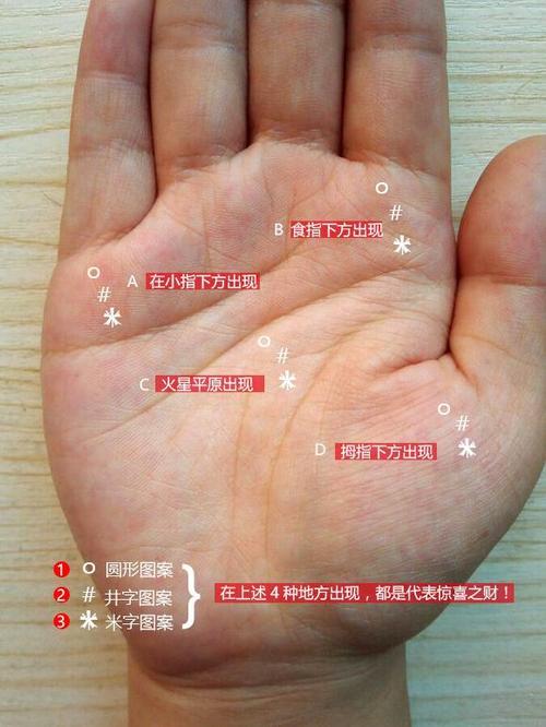 男女掌心长痣代表什么