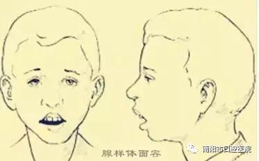 医生:用这4招改善很管用