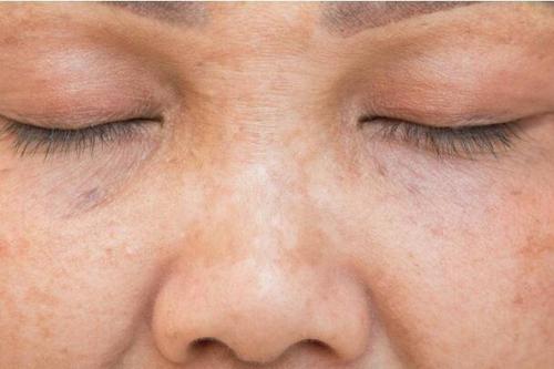 肝癌临近,身体4处变化"藏不住",乙肝患者占一个,要