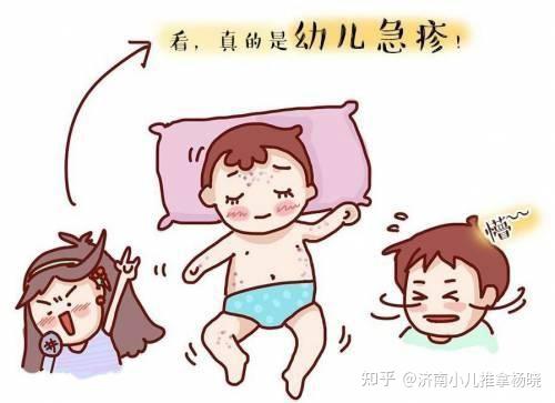 幼儿急疹应该怎么办