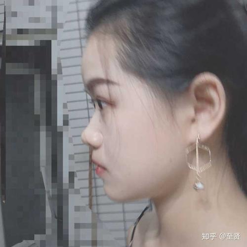 侧脸丑而正脸好看是一种什么体验?