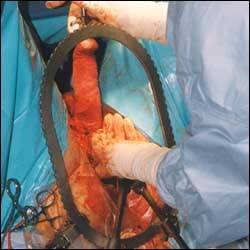 《变性手术男变女过程》场面恶心慎入!