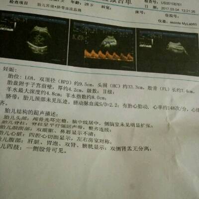 38周,请问胎儿发育怎麼样?