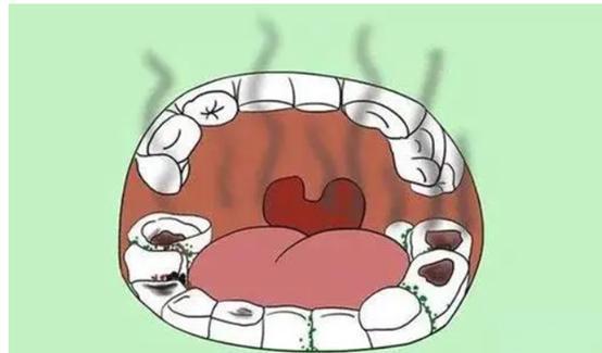 胃部假如烂透了身体有3表现别傻傻拖成胃癌才就医