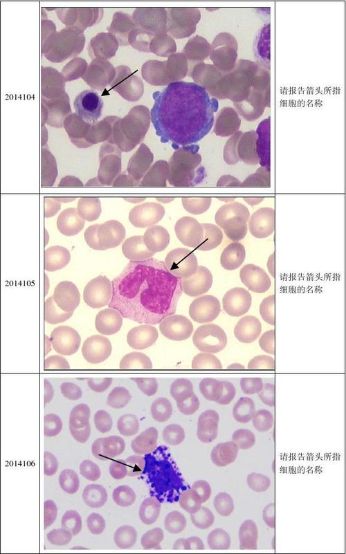 2014年第1次血细胞形态学检查室间质量评价