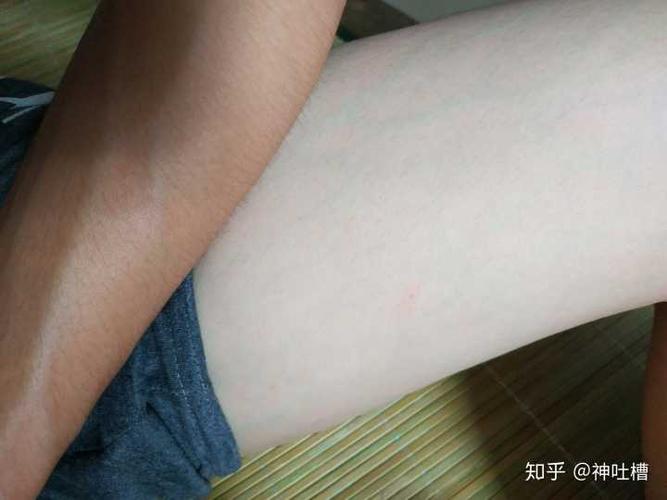 你怎么把皮肤养白的,有图可以回答?