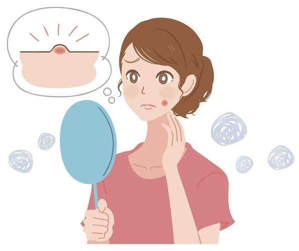 为什么会长成人痘?如何有效呵护痘痘肌以及痘印问题?