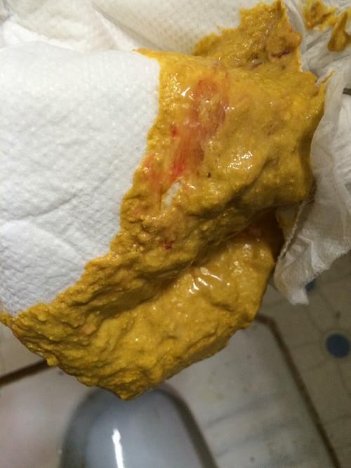 怎么回事_百度宝宝知道