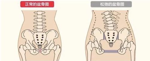 【闻禧享悦时光月子会所】干货 || 骨盆变形危害大,产后妈妈必须注意