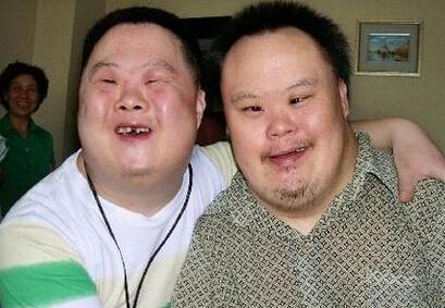 唐氏综合症的早期干预