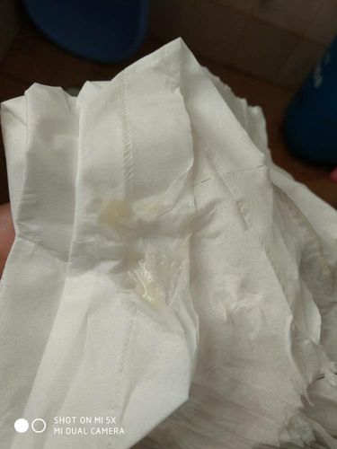 无异味,有的时候有透明白带,但是脓性貌似带点黄