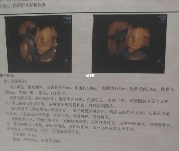 22周四维_滤镜_母婴_孕产经验