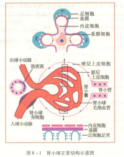 肾小球肾炎病理图解