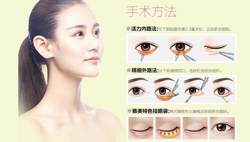去眼袋手术的手术方法的切口一般设计在离下眼睑睫毛缘2-3毫米的地方