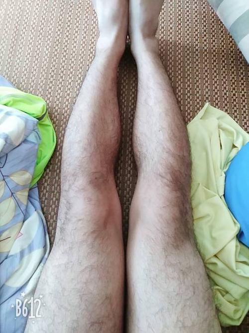 请帮我看看我的腿是o型腿还是xo,我的小腿骨头已经变形了是吗,变成弯