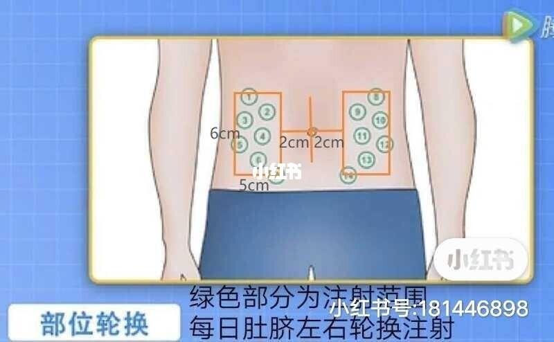 注射生长激素3个月效果_跳绳_生长激素_医疗健康_医疗