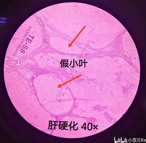 病理学实验切片