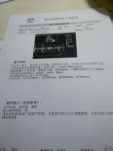 横位可以顺产吗