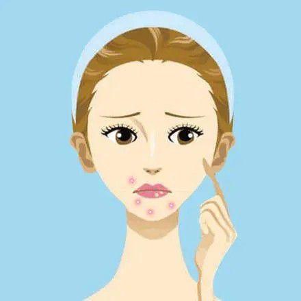 脸上长痘痘,用优思悦可以治好吗?