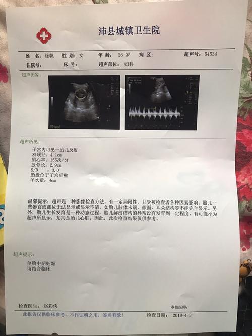 这是孕18周,孕24周四维,孕28周,孕31周和孕34周的检