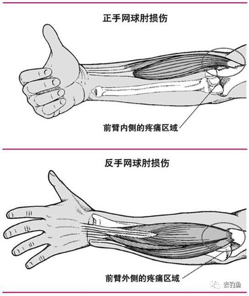 钓鱼人,小心你的胳膊肘!