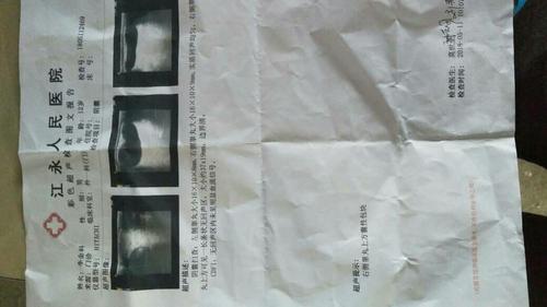 12岁儿童睾丸一大一小是怎么回事