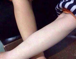 手臂很黑,怎样变白,简单有效快捷