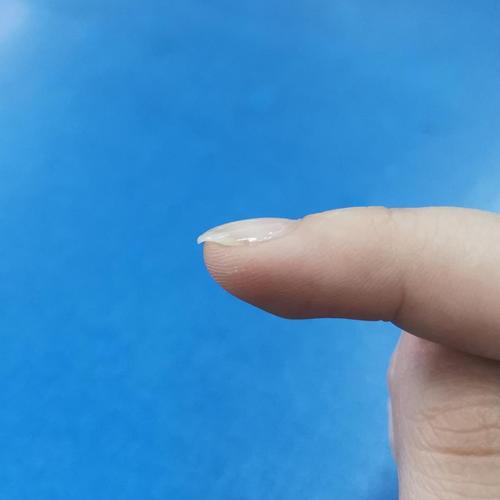 指甲向下抠很严重,是什么问题呢?(图片有更新)