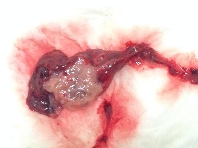 药流孕囊最晚多久排出:怀孕45天的胚胎有多大图片