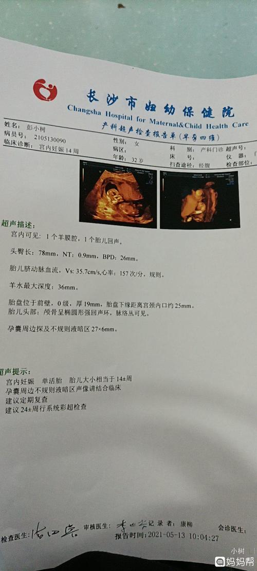 宝宝有14周了请问有谁会看男女