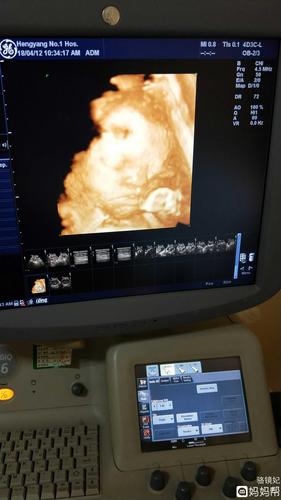 宝宝四维照片像爸爸是不是怕不够漂亮所以